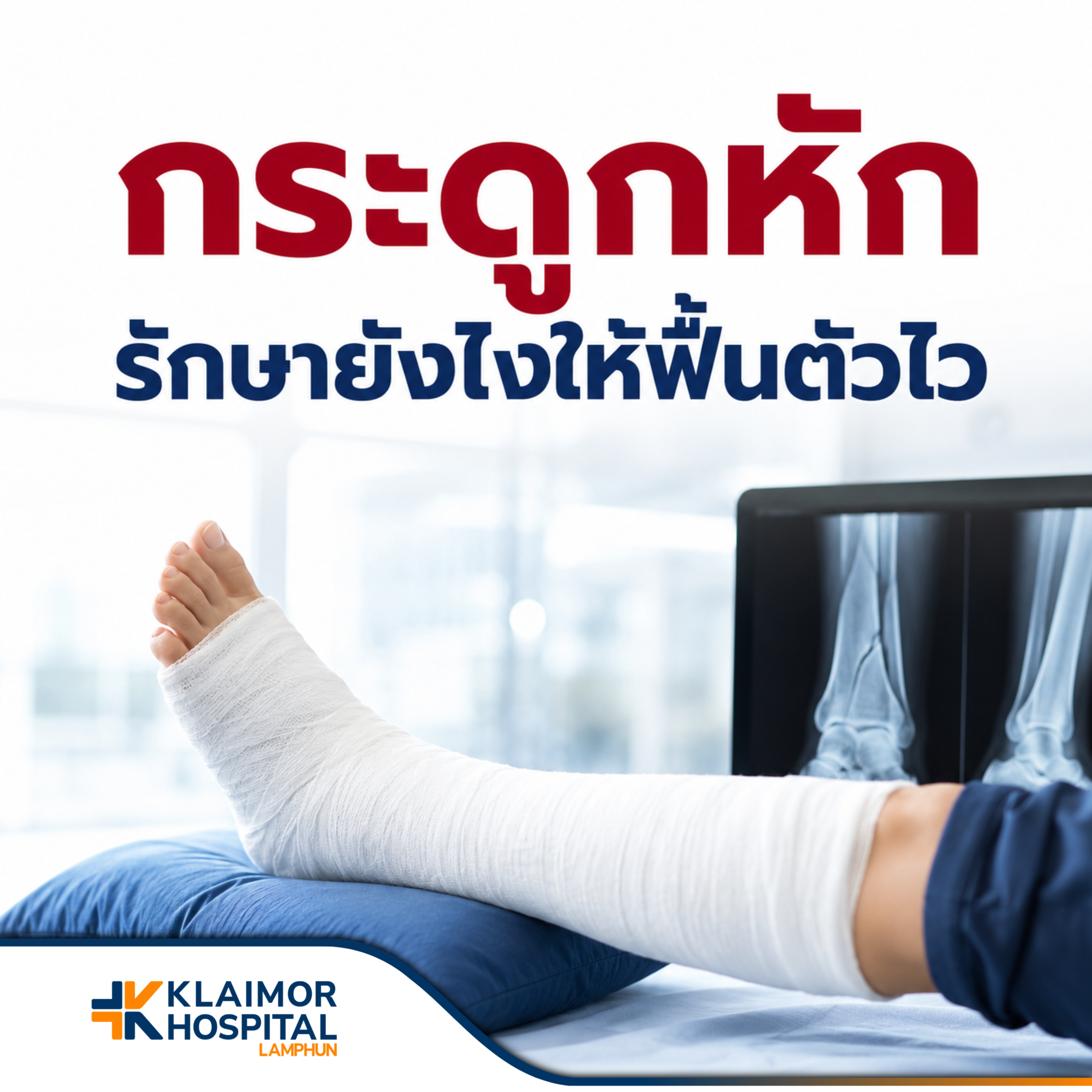 กระดูกหัก รักษายังไงให้ฟื้นตัวไวและตอบโจทย์ไลฟ์สไตล์