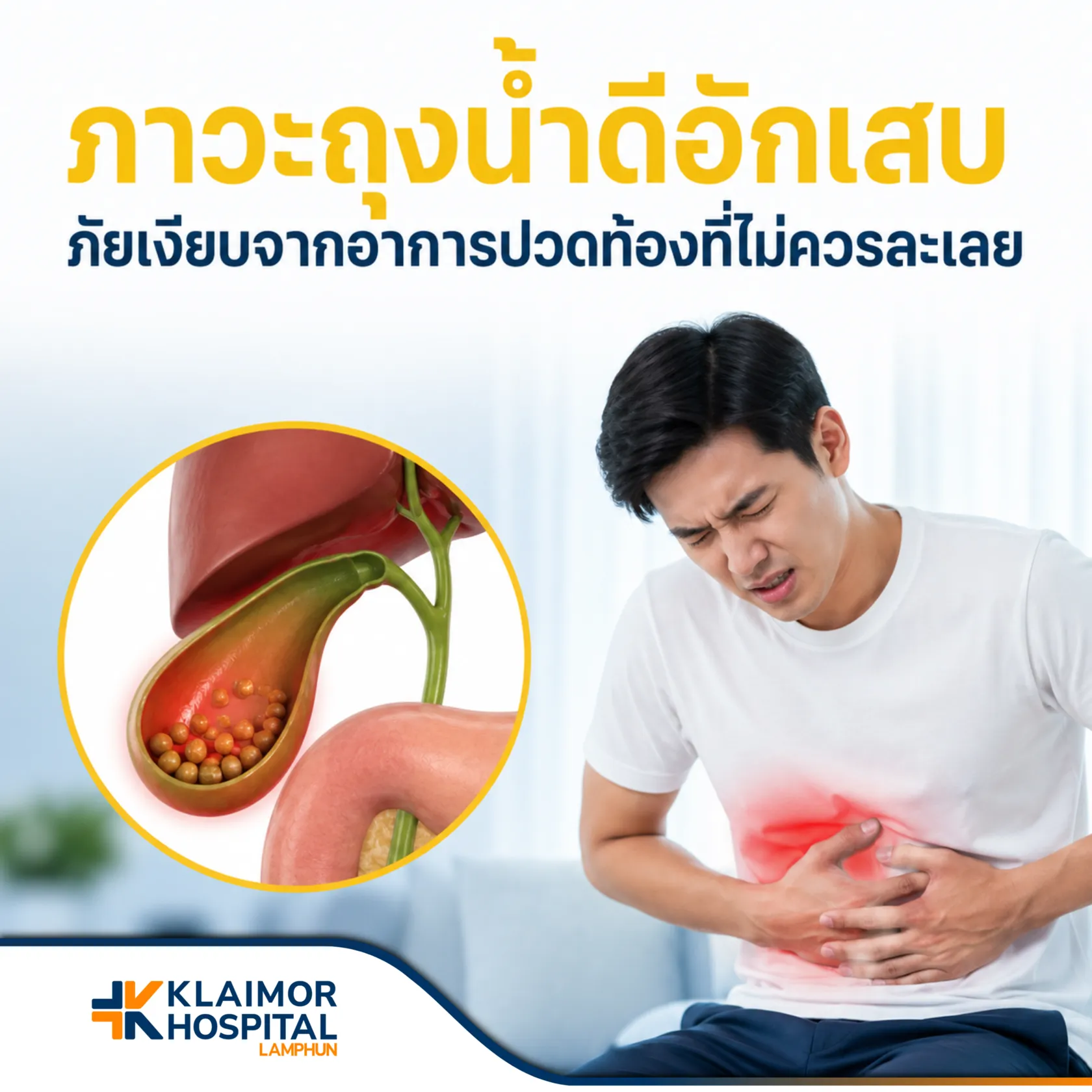 ภาวะถุงน้ำดีอักเสบ ภัยเงียบจากอาการปวดท้องที่ไม่ควรละเลย