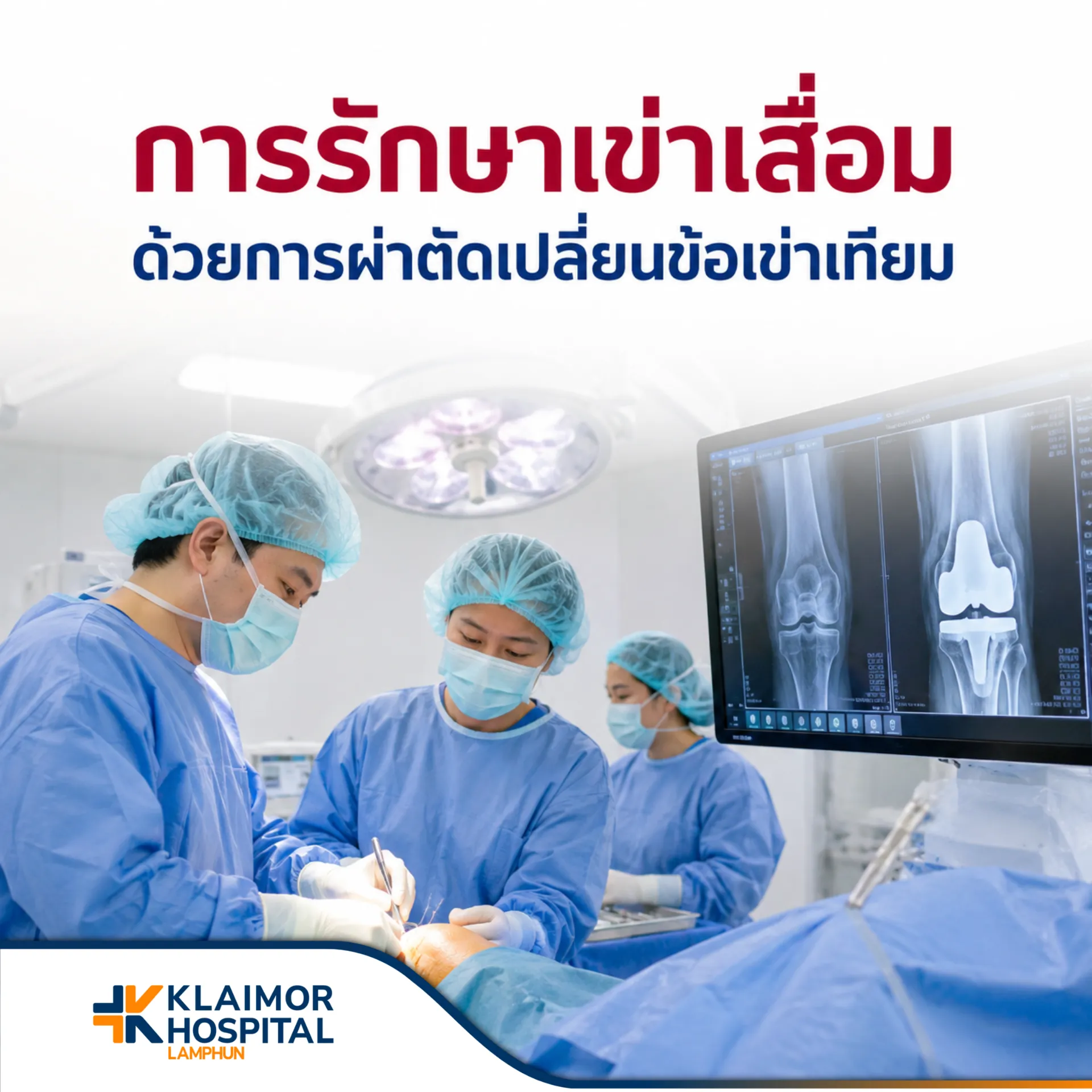 การรักษาเข่าเสื่อมด้วยการผ่าตัดเปลี่ยนข้อเข่าเทียม