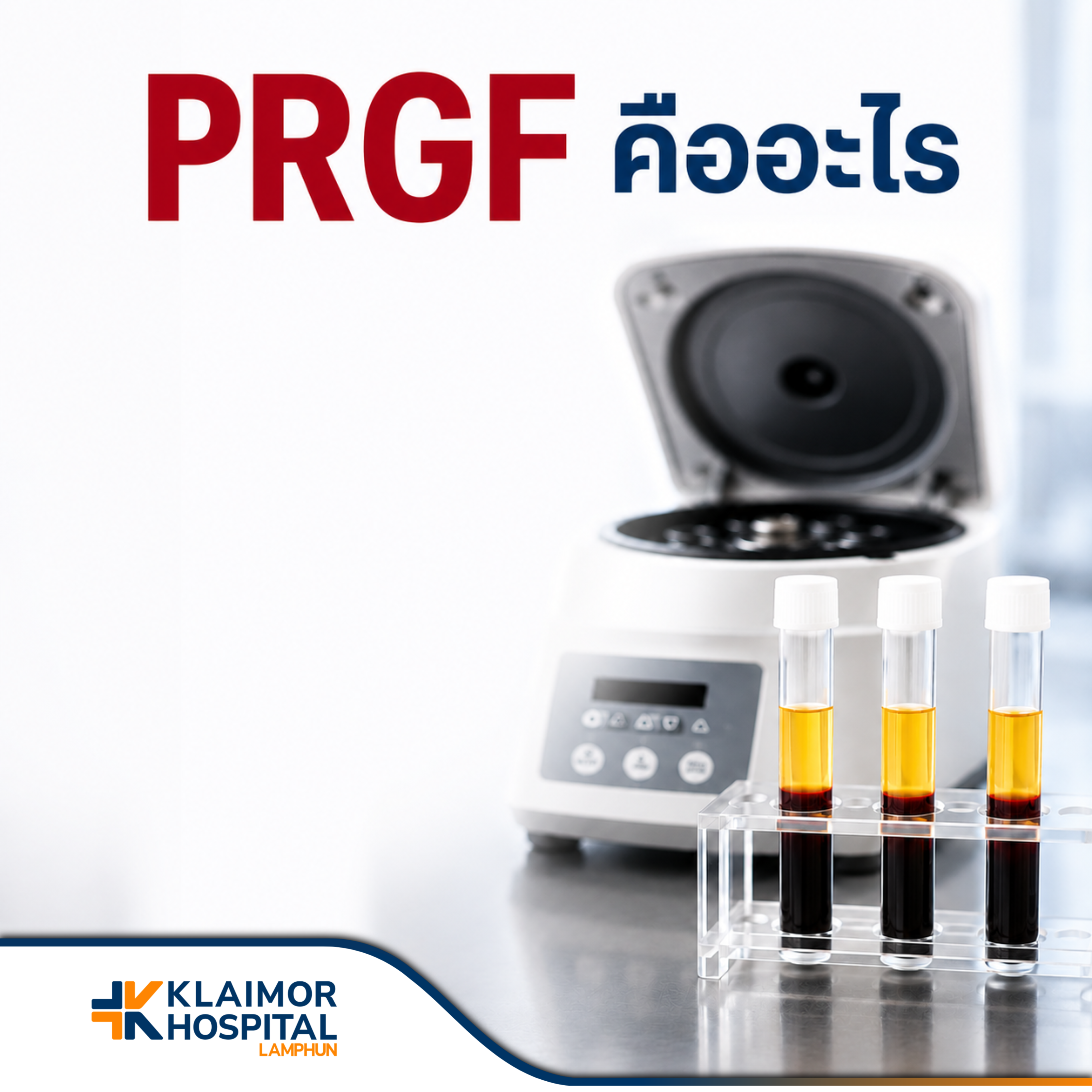 PRGF คืออะไร? นวัตกรรมฟื้นฟูร่างกายด้วยพลาสมาจากเลือดตัวเอง