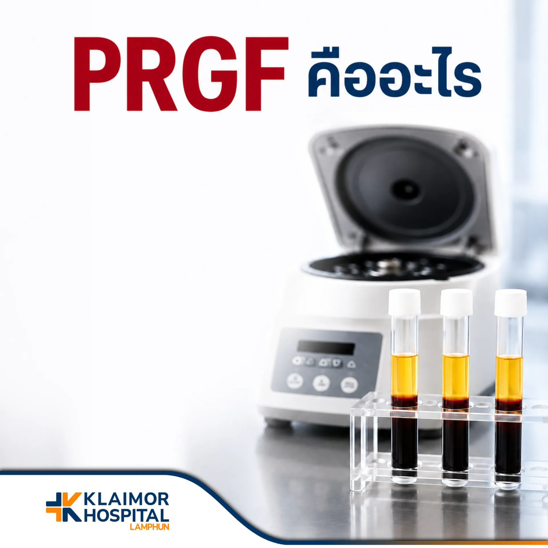 PRGF คืออะไร? นวัตกรรมฟื้นฟูร่างกายด้วยพลาสมาจากเลือดตัวเอง