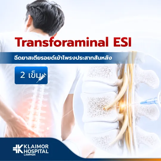 ฉีดยาสเตียรอยด์เข้าโพรงประสาทสันหลัง 2 เข็ม
